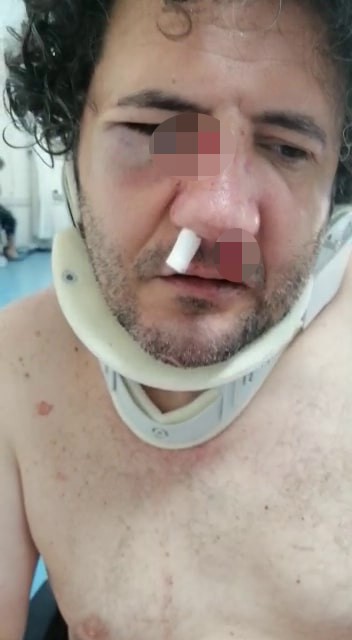 Nafaka yüzünden öldüresiye dövüldü