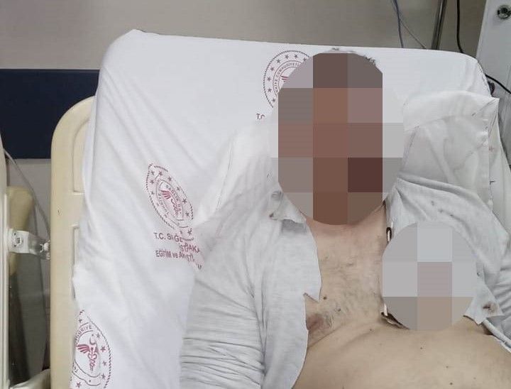 Taksim’de yaşanan patlamada Hakan Çınal yaralandı