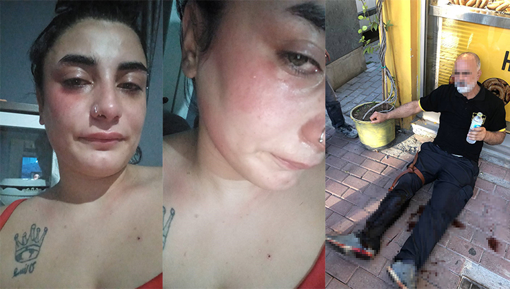 Hamile kadını darp eden şahsın iş yerine silahlı saldırı: 2 yaralı